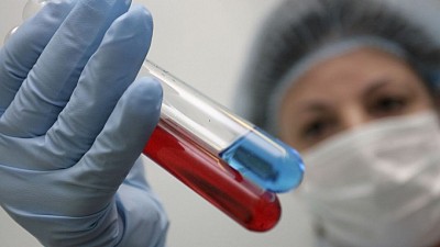 In England, there are fears of a new surge in HIV infections.